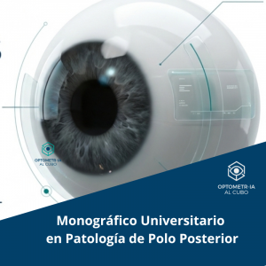 Monográfico en Patología de Polo Posterior